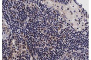 ABIN6267432 at 1/200 staining human lymph nodes tissue sections by IHC-P. (NFKB1 anticorps  (pSer907))