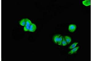 Immunofluorescent analysis of MCF-7 cells using ABIN7172041 at dilution of 1:100 and Alexa Fluor 488-congugated AffiniPure Goat Anti-Rabbit IgG(H+L)