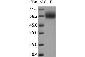Western Blotting (WB) image for Neurotrophic Tyrosine Kinase, Receptor, Type 2 (NTRK2) (Active) protein (His tag) (ABIN7197182) (TRKB Protein (His tag))
