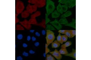 ABIN6265135 and ABIN6279127 staining Hela cells by IF/ICC.