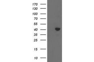 HEK293T cells were transfected with the pCMV6-ENTRY control (Left lane) or pCMV6-ENTRY ACAT2 (Right lane) cDNA for 48 hrs and lysed. (ACAT2 anticorps)