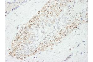 anti-WD Repeat Domain 91 (WDR91) (AA 250-300) antibody