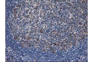 Image no. 1 for anti-Dihydrolipoamide Dehydrogenase (DLD) antibody (ABIN1497847) (DLD anticorps)