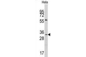 Western Blotting (WB) image for anti-Melanoma Antigen Family A, 1 (Directs Expression of Antigen MZ2-E) (MAGEA1) antibody (ABIN3002531) (MAGEA1 anticorps)