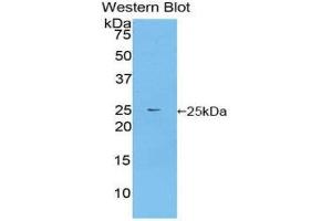 Western Blotting (WB) image for anti-Fibroblast Growth Factor Receptor Substrate 2 (FRS2) (AA 268-453) antibody (ABIN1858918) (FRS2 anticorps  (AA 268-453))