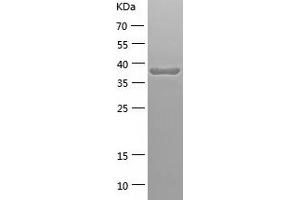 Western Blotting (WB) image for Coproporphyrinogen Oxidase (CPOX) (AA 111-454) protein (His tag) (ABIN7122483)