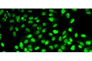 Immunofluorescence analysis of HeLa cells using PBEF / NAMPT Polyclonal Antibody (NAMPT anticorps)