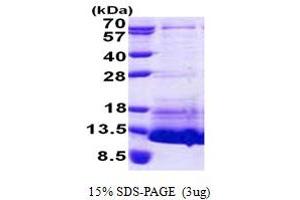 SDS-PAGE (SDS) image for Natriuretic Peptide Type C (NPPC) (AA 24-126) protein (His tag) (ABIN5853084) (NPPC Protein (AA 24-126) (His tag))