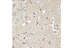 Immunohistochemistry of paraffin-embedded human brain using SR-B2/SR-B2/LIMPII Rabbit mAb (ABIN7270157) at dilution of 1:100 (40x lens). (SCARB2 anticorps)