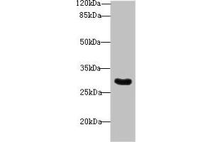 Western blot All lanes: Snrnp35 antibody at 12 μg/mL + Jurkat whole cell lysate Secondary Goat polyclonal to rabbit IgG at 1/10000 dilution Predicted band size: 29 kDa Observed band size: 29 kDa (SNRNP35 anticorps  (AA 1-244))