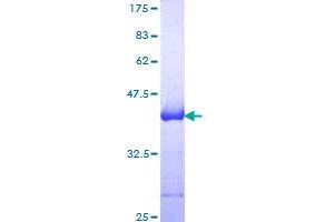 Image no. 1 for Neural Cell Adhesion Molecule 1 (NCAM1) (AA 611-710) protein (GST tag) (ABIN1312059)