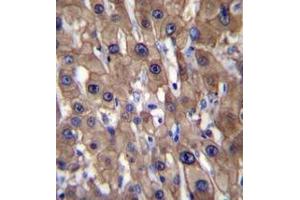 Immunohistochemistry analysis in formalin fixed and paraffin embedded human liver tissue reacted with MAT1A Antibody (N-term) followed which was peroxidase conjugated to the secondary antibody and  followed by DAB staining. (MAT1A anticorps  (N-Term))