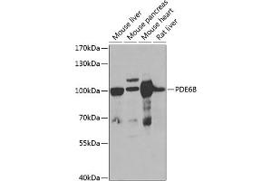 Western blot analysis of extracts of various cell lines, using PDE6B antibody (ABIN6132473, ABIN6145363, ABIN6145364 and ABIN6222688) at 1:1000 dilution. (PDE6B anticorps  (AA 1-190))