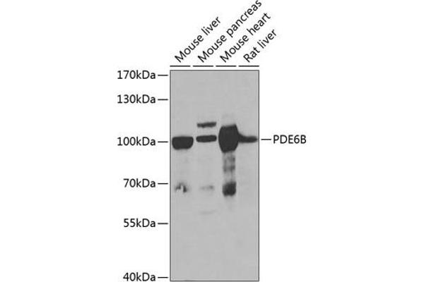 PDE6B Antikörper  (AA 1-190)