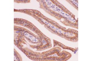 Anti-CTNNA1 Picoband antibody,  IHC(P): Mouse Intestine Tissue