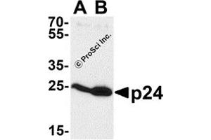 Western Blotting (WB) image for anti-Human Immunodeficiency Virus 1 Capsid (HIV-1 p24) antibody (ABIN1077455) (HIV-1 p24 anticorps)