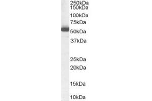 Image no. 1 for anti-Aldehyde Dehydrogenase 1 Family, Member A1 (ALDH1A1) (Internal Region) antibody (ABIN374658) (ALDH1A1 anticorps  (Internal Region))