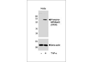 Western blot analysis of lysates from Hela cell line, untreated or treated with TNF-α, 20 ng/mL, using Phospho-NFKBp65 Antibody  (upper) or Beta-actin (lower).
