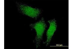 Immunofluorescence of monoclonal antibody to RUVBL1 on HeLa cell. (RUVBL1 anticorps  (AA 1-456))