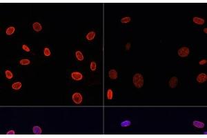 Immunofluorescence analysis of NIH/3T3 cells using Acetyl-Histone H4-K91 Polyclonal Antibody at dilution of 1:100. (Histone H4 anticorps  (acLys91))