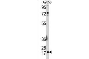 Western Blotting (WB) image for anti-Ubiquitin-Conjugating Enzyme E2I (UBE2I) antibody (ABIN2995752) (UBE2I anticorps)