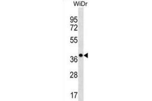Western Blotting (WB) image for anti-Chloride Channel Accessory 3, Pseudogene (CLCA3P) antibody (ABIN3000478) (CLCA3P anticorps)