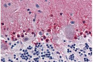 Human Brain, Cerebellum: Formalin-Fixed, Paraffin-Embedded (FFPE) (CBS anticorps  (AA 1-101))
