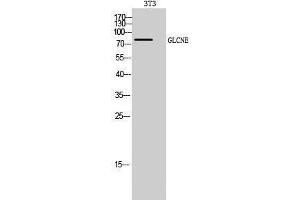 Western Blotting (WB) image for anti-Glucosamine (UDP-N-Acetyl)-2-Epimerase/N-Acetylmannosamine Kinase (GNE) (C-Term) antibody (ABIN3184799) (GNE anticorps  (C-Term))