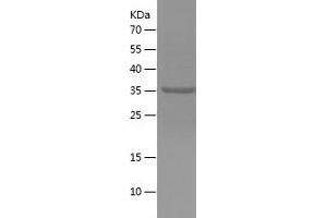 Western Blotting (WB) image for Myosin, Light Chain 1, Alkali, Skeletal, Fast (MYL1) (AA 1-150) protein (His-IF2DI Tag) (ABIN7124071)