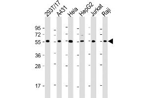 All lanes : Anti-alpha Tubulin Antibody at 1:2000 dilution Lane 1: 293T/17 whole cell lysate Lane 2: A431 whole cell lysate Lane 3: Hela whole cell lysate Lane 4: HepG2 whole cell lysate Lane 5: Jurkat whole cell lysate Lane 6: Raji whole cell lysate Lysates/proteins at 20 μg per lane. (alpha Tubulin anticorps  (AA 408-439))