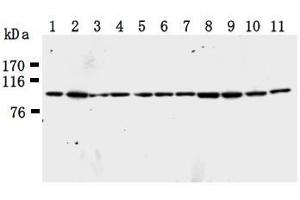 Western Blotting (WB) image for anti-Karyopherin (Importin) beta 1 (KPNB1) antibody (ABIN1449199) (KPNB1 anticorps)