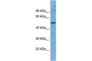 Host:  Rabbit  Target Name:  SLC5A7  Sample Type:  ACHN Whole Cell lysates  Antibody Dilution:  1. (ChT anticorps  (C-Term))
