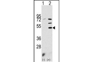 Western blot analysis of PDK3 (arrow) using rabbit polyclonal PDK3 Antibody (N-term) (ABIN391038 and ABIN2841204). (PDK3 anticorps  (N-Term))