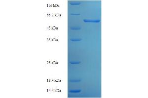 SDS-PAGE (SDS) image for Alanine Glyoxylate Aminotransferase (AGXT) (AA 25-414) protein (His-SUMO Tag) (ABIN5709015)