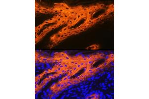 Immunofluorescence analysis of human skin using Cytokeratin 2e (KRT2) Rabbit mAb (ABIN1680763, ABIN3016322, ABIN3016323 and ABIN7101480) at dilution of 1:100 (40x lens).