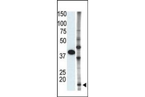 Image no. 1 for anti-Small Ubiquitin Related Modifier 2 (SUMO2) (C-Term) antibody (ABIN356794) (SUMO2 anticorps  (C-Term))