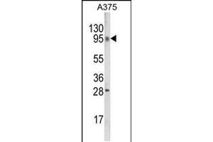 Chromosome 6 Open Reading Frame 170 (C6ORF170) (AA 112-139), (N-Term) anticorps