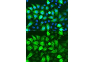 Immunofluorescence analysis of A549 cells using RRM2 antibody. (RRM2 anticorps)