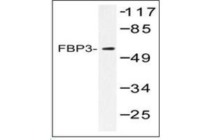 Image no. 2 for anti-Far Upstream Element (FUSE) Binding Protein 3 (FUBP3) antibody (ABIN317906) (FUBP3 anticorps)