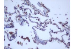 Image no. 6 for anti-DEAD (Asp-Glu-Ala-Asp) Box Polypeptide 59 (DDX59) (AA 1-303) antibody (ABIN1490728) (DDX59 anticorps  (AA 1-303))