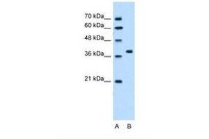 Image no. 2 for anti-RUN Domain Containing 2A (RUNDC2A) (N-Term) antibody (ABIN321330) (SNX29 anticorps  (N-Term))
