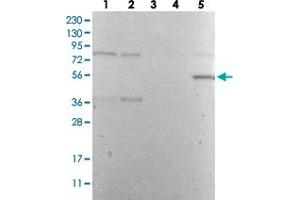 Western Blot analysis with DES polyclonal antibody  Lane 1: Human cell line RT-4 Lane 2: Human cell line U-251MG sp Lane 3: Human plasma (IgG/HSA depleted) Lane 4: Human liver tissue Lane 5: Human tonsil tissue (Desmin anticorps)