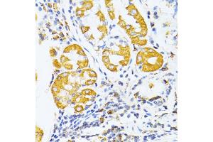 Immunohistochemistry of paraffin-embedded human stomach using MMP2 antibody (ABIN1882374) at dilution of 1:100 (40x lens). (MMP2 anticorps)