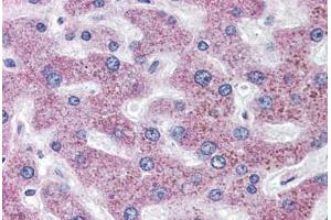 Anti-SLC5A11 antibody  ABIN1049343 IHC staining of human liver.