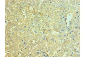 Immunohistochemistry of paraffin-embedded human liver tissue using ABIN7161572 at dilution of 1:100 (NAMPT anticorps  (AA 1-280))