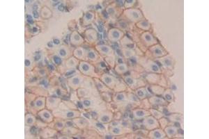 Used in DAB staining on fromalin fixed paraffin- embedded Kidney tissue (TREM2 anticorps  (AA 1-228))