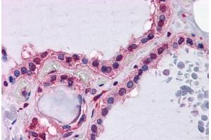 Human Thyroid: Formalin-Fixed, Paraffin-Embedded (FFPE) (Hepcidin anticorps  (AA 25-85))