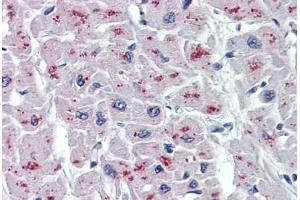 Human Heart: Formalin-Fixed, Paraffin-Embedded (FFPE)