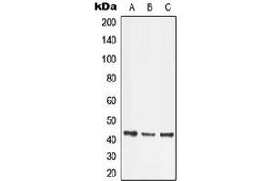 Western blot analysis of LMX1B expression in HeLa (A), Jurkat (B), SP2/0 (C) whole cell lysates. (LMX1B anticorps  (Center))
