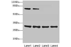 Western blot All lanes: SPIN3 antibody at 6 μg/mL Lane 1: A549 whole cell lysate Lane 2: Hela whole cell lysate Lane 3: A431 whole cell lysate Lane 4: HepG2 whole cell lysate Secondary Goat polyclonal to rabbit IgG at 1/10000 dilution Predicted band size: 30, 9 kDa Observed band size: 30, 70 kDa (SPIN3 anticorps  (AA 1-77))